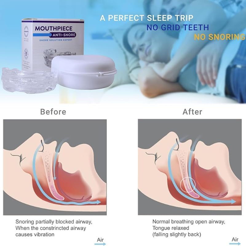 Anti-Snoring Mouth Guard – Reusable Dental Guard for Snoring & Teeth Grinding | Sleep Aid for Men & Women