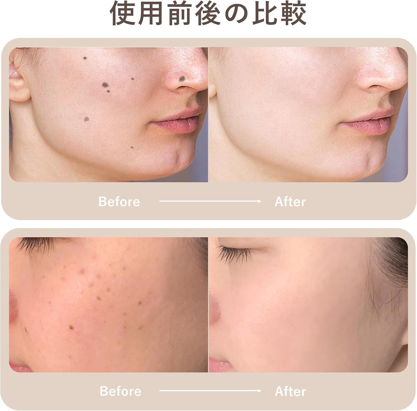 Beauty Pen Laser Tool – 9-Speed USB Rechargeable, Portable Unisex Gold