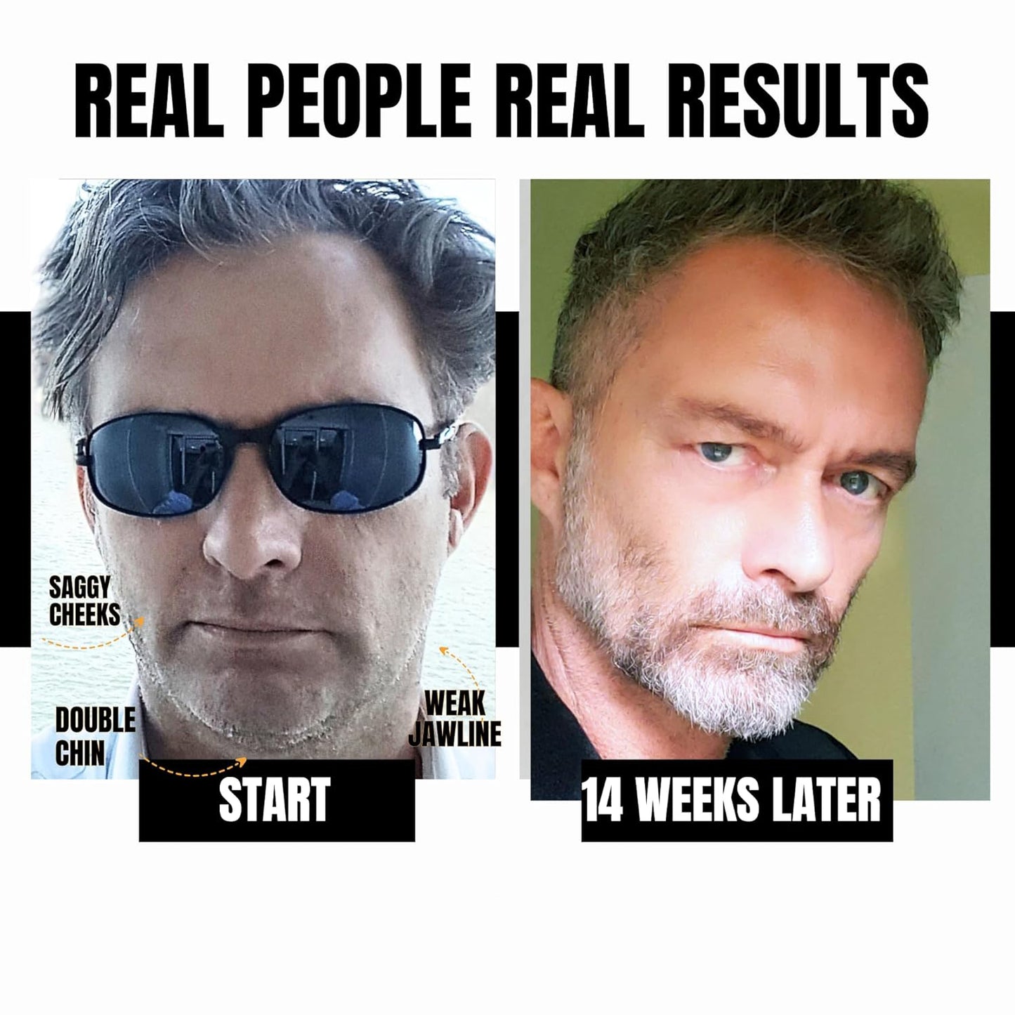 Face Sculpting Gym Kit – 4 Tools for a Complete Facial Workout