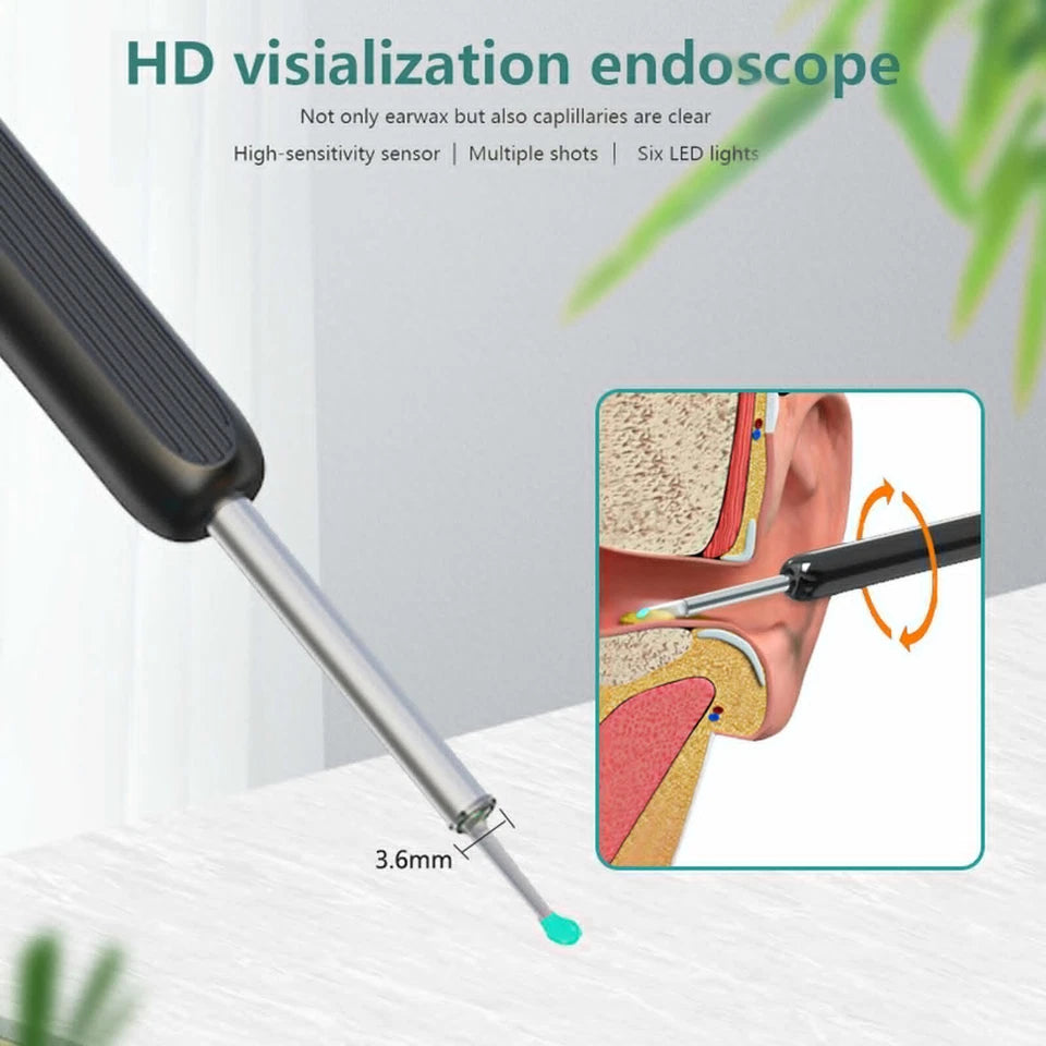 Professional Earwax Removal Cleaner with LED Light – Wireless Otoscope